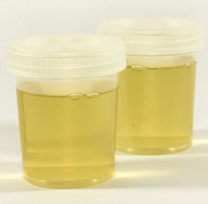 Urine Causes Yellow Semen